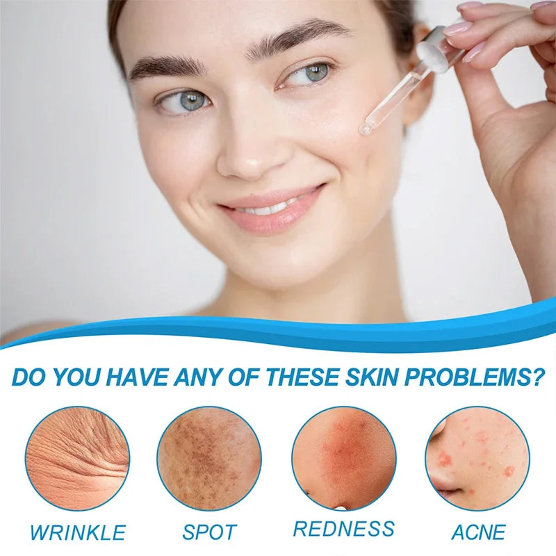 Woman applying facial serum with dropper for wrinkle, spot, redness, and acne treatment